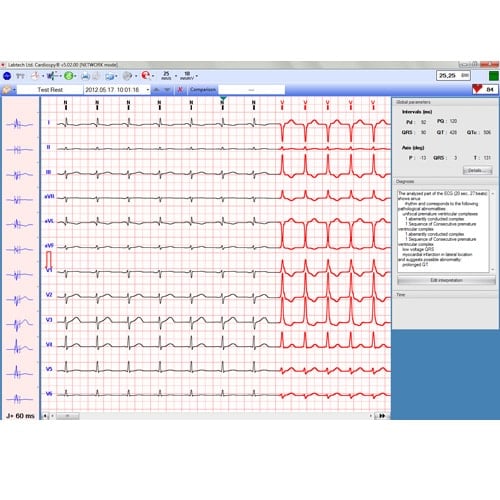 EC-12R PC-Ruhe-EKG