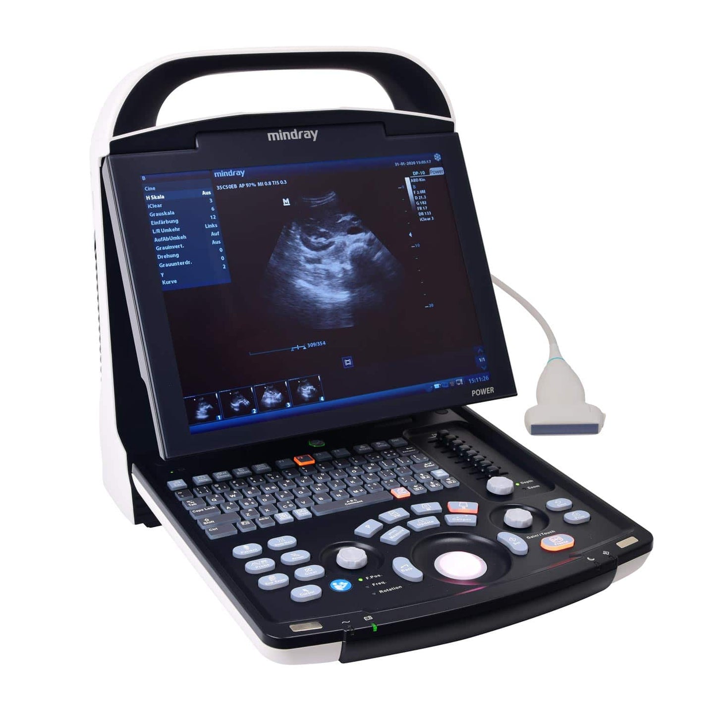 Mindray DP 30