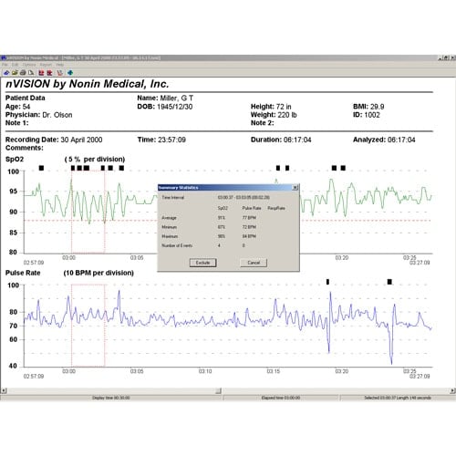 nVISION Datenmanagement-Software
