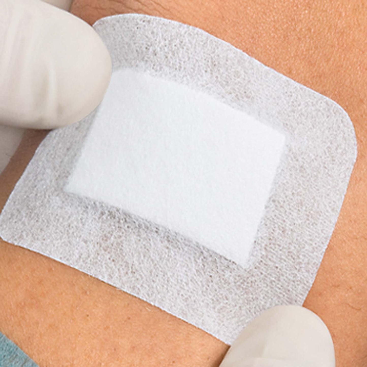 Cosmopor® Advance Wundverband
