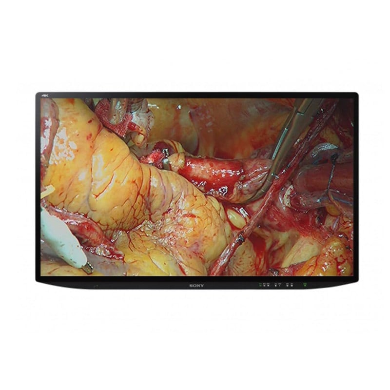 Sony Corporation - SONY Monitor