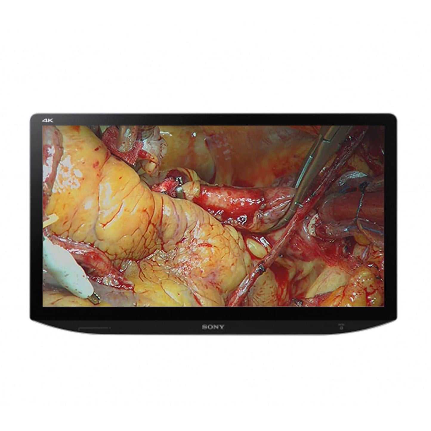 Sony Corporation - SONY Monitor - LMD-X310MT