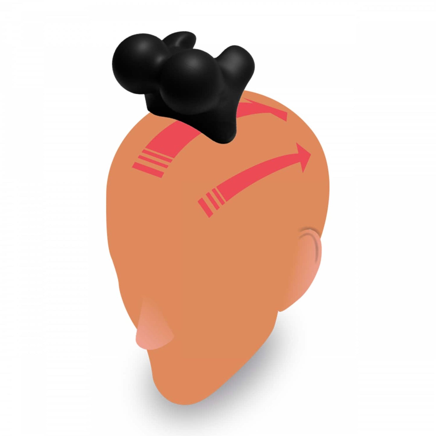 TMX Trigger - TMX® DURA Nackentrigger