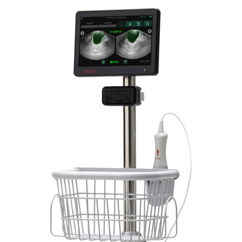 Vitascan cVue Blasenscanner
