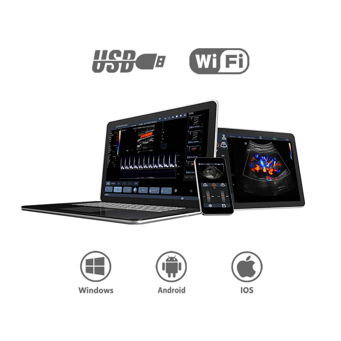 Mobiles Ultraschallsystem Youkey D8 Ausführung Schwarz/Weiß | ohne Sonde