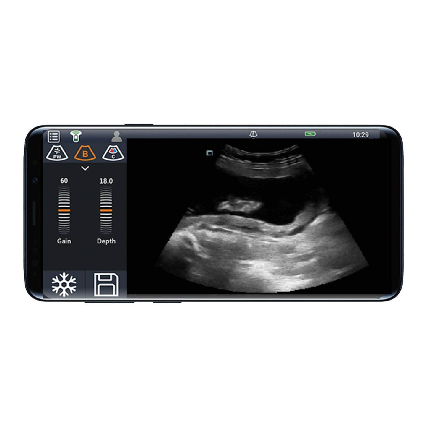 Mobiles Ultraschallsystem Youkey D8 Ausführung Schwarz/Weiß | ohne Sonde