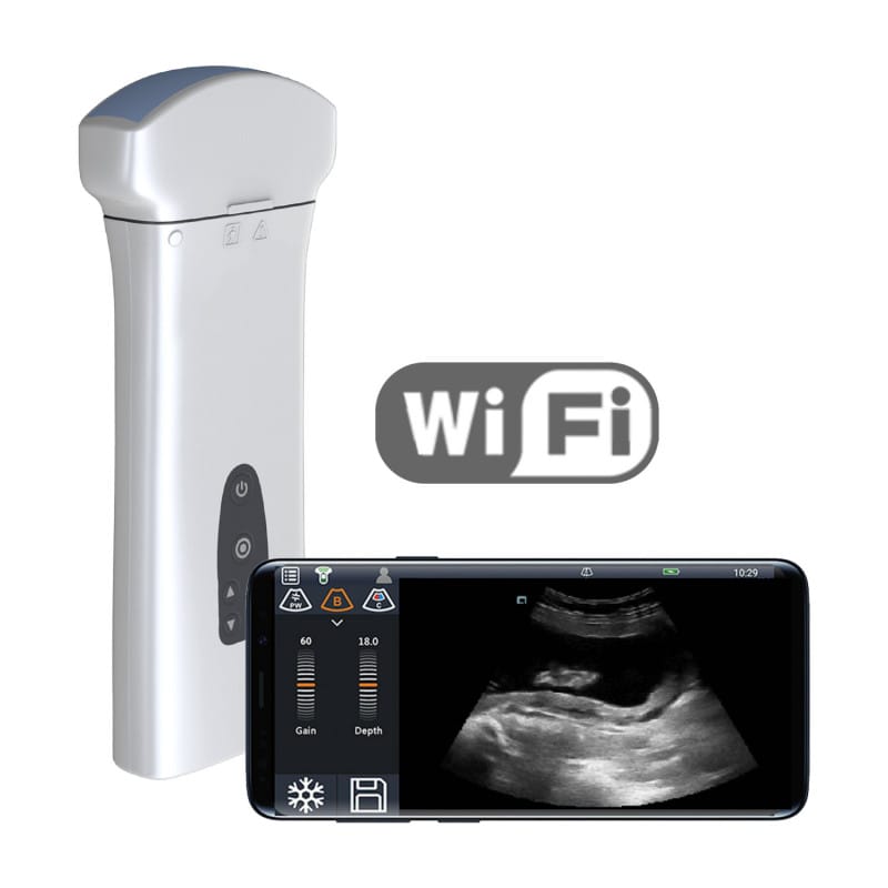 Mobiles Ultraschallsystem Youkey D8 Ausführung Schwarz/Weiß | ohne Sonde