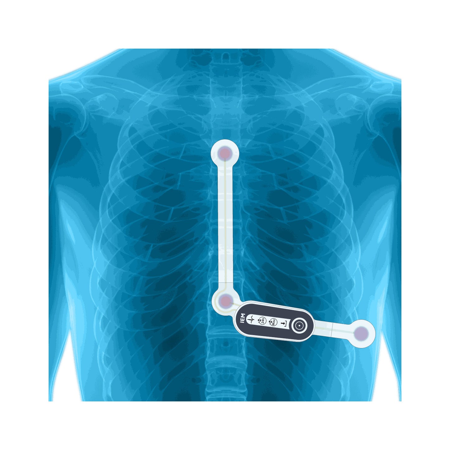 HeartX | günstig kaufen