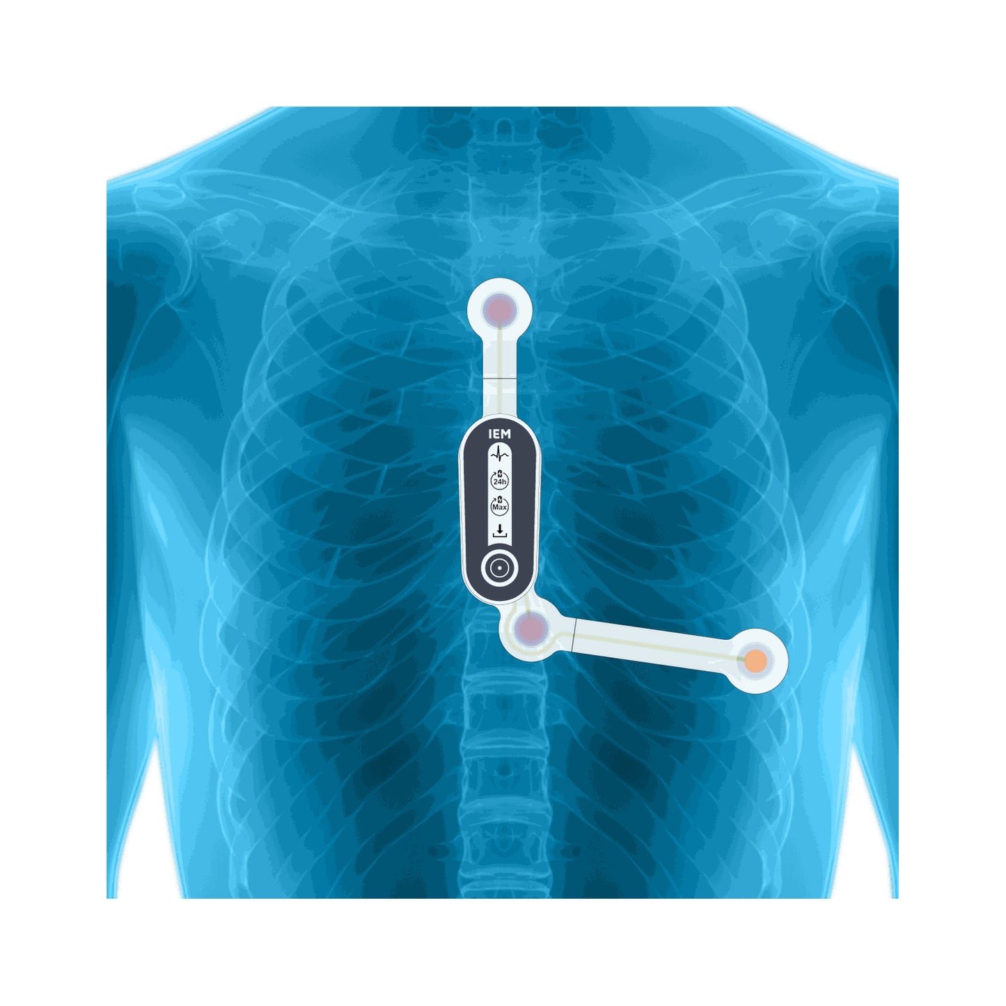 HeartX | günstig kaufen