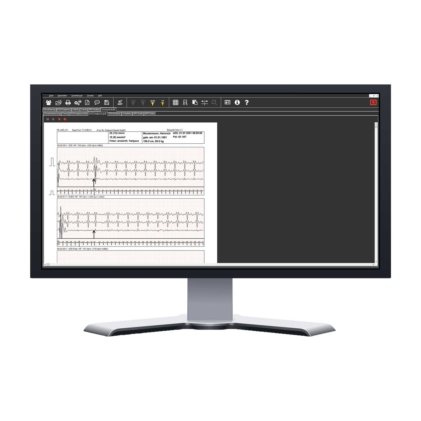 Langzeit-EKG Kobold II Auswertepaket | günstig kaufen