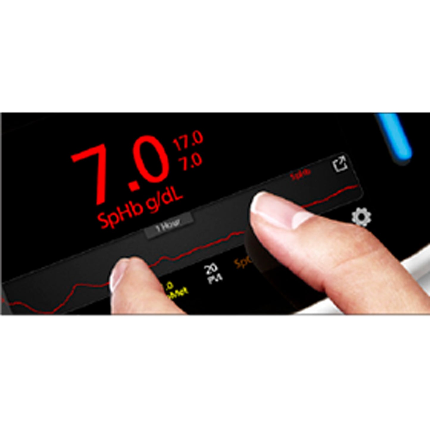 Radical-7® Pulse CO-Oximeter® | günstig kaufen