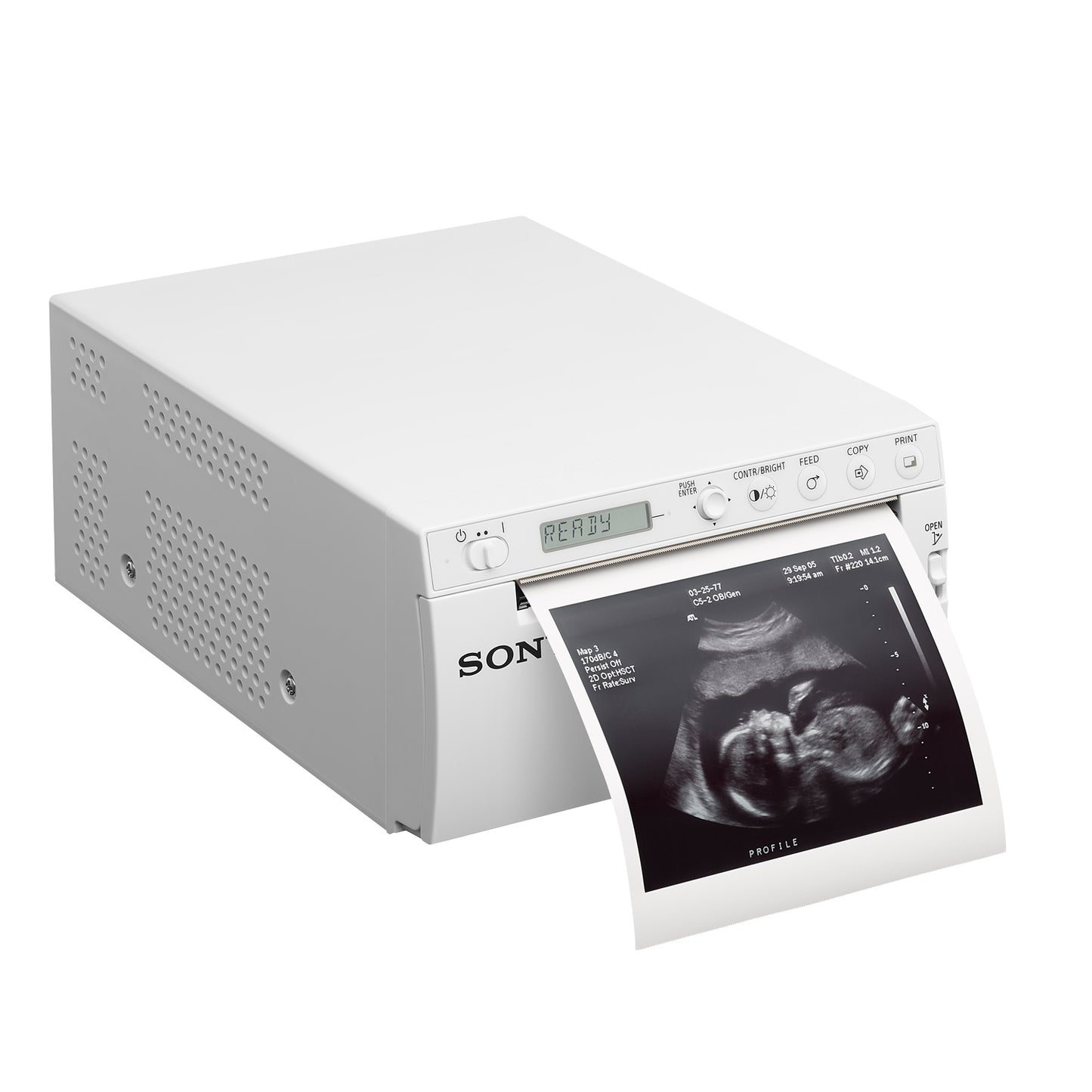 SONY UP-X899MD Videoprinter | günstig kaufen