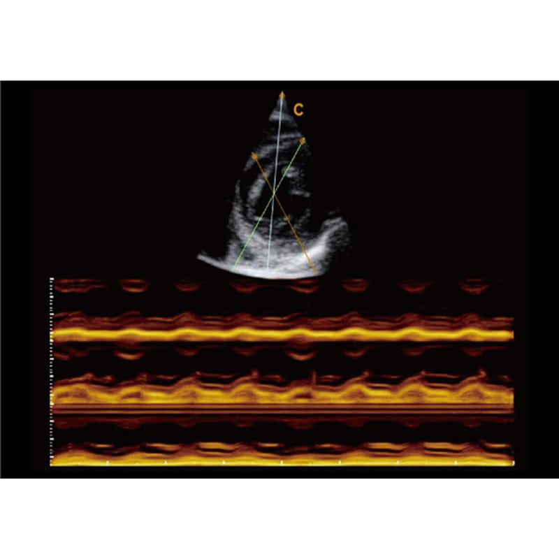 CBit6 Ultraschallgerät