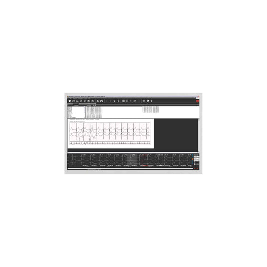 SmartHolter24 Holter-EKG-Gerät