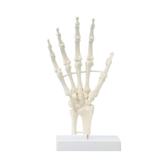 Handskelett mit Strukturen, unbeweglich
