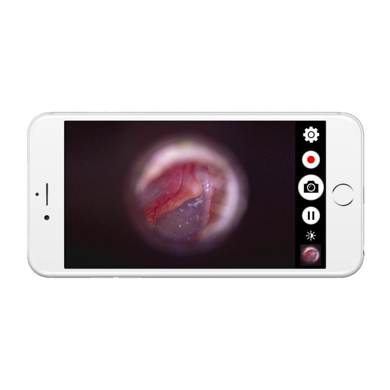 Firefly DE 1270 digitale HD-Endoskopkamera