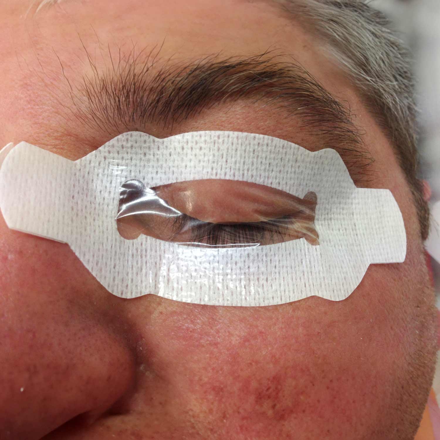 F2 Augenschutz-Set – 5 Paar Schutzbrillen Mit Anti-Beschlag-Beschichtung, Medizinisches Zubehör