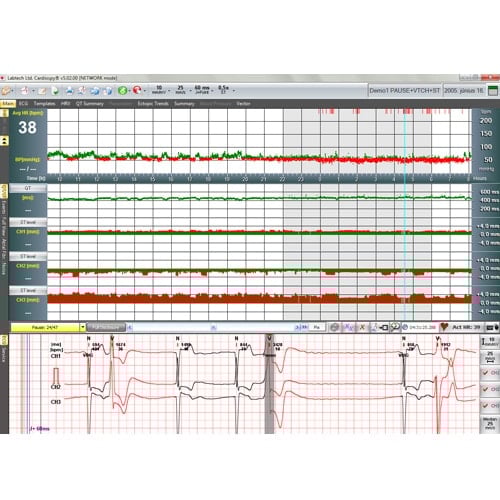 EC-3H Langzeit-EKG-Gerät