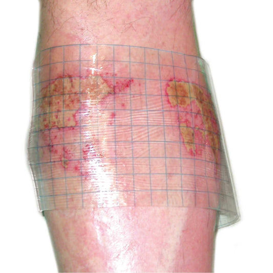 HydroTac transparent Gelverband