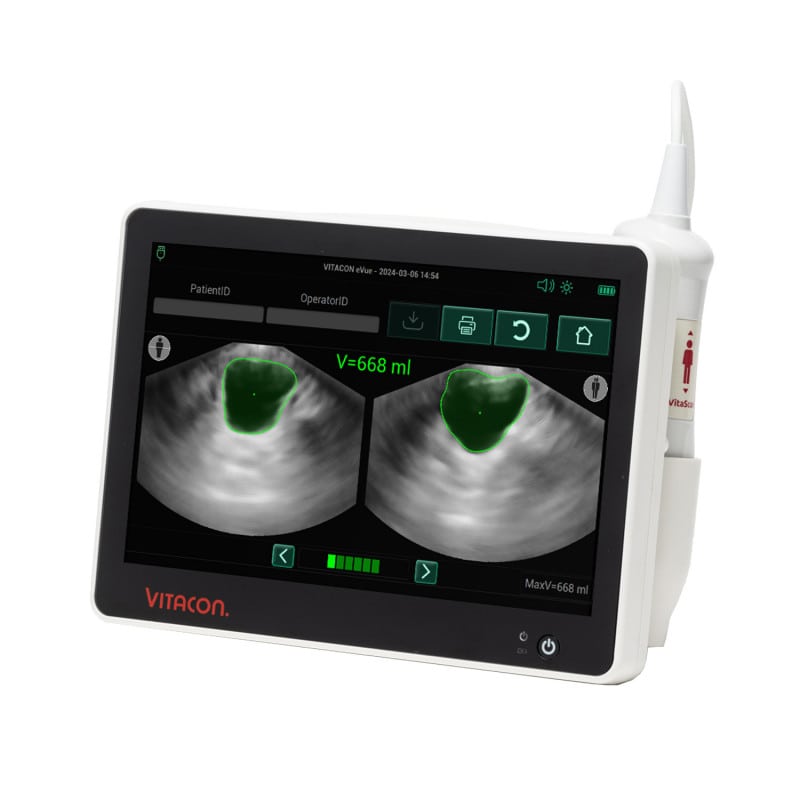 Vitascan eVue Blasenscanner