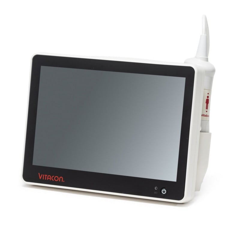 Vitascan eVue Blasenscanner