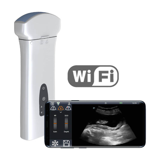 Mobiles Ultraschallsystem Youkey D8 Ausführung Schwarz/Weiß | ohne Sonde