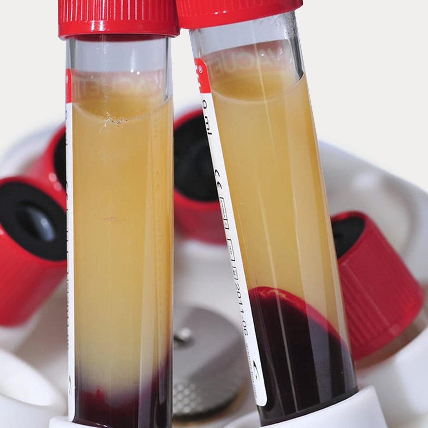 Medizinische Zentrifuge MEDIFUGE CGF