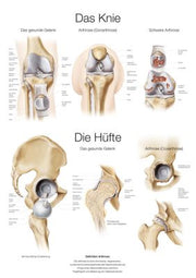 Lehrtafel "Das Knie / Die Hüfte" (deutsch), verschiedene Größen